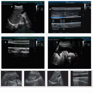 Human <b>Ultrasound</b> Scanner Line Array Vet <b>Ultrasound</b> <b>Machine</b> for Hands - Product Image 4