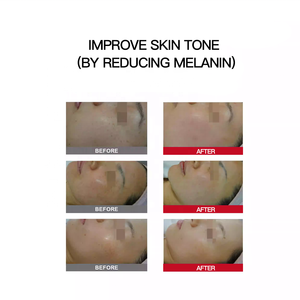 ZXIUER Tıbbi Sınıf Somon <span class=keywords><strong>DNA</strong></span>'sı İçeren 5ml 10 Şişe Yüz Cilt Bakım Serumu Centella Beyazlatıcı Yoğun Evde Kullanım - Product Image 6