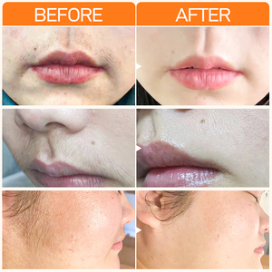 Bán Buôn Lip Tóc Loại Bỏ Kem Nhãn Hiệu Riêng Hữu Cơ Nhanh Chóng Ngay Lập Tức Vĩnh Viễn Không Đau Tóc Loại Bỏ Kem Cho Dody Và Môi - Product Image 5