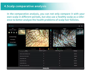 hair scalp analyzer skin and scalp analyzer with ai Scalp Analysis Device Scalp Treatment <b>Machine</b> Hair Growth Scalp <b>Massager</b> - Product Image 6