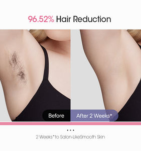 Dispositivo Portátil de Depilación Láser IPL para Uso Doméstico, Máquina de Depilación Permanente para Mujeres y Hombres, Segura e Indolora - Product Image 3