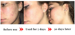 Jabón Kojic de Marca Privada 65g* 2 con Logotipo Personalizado, Orgánico, con Aceite de Árbol de Té, Libre de Crueldad Animal, Envoltorio de Regalo - Product Image 5