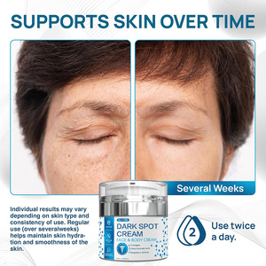 1.85 Floz 55 ml nemlendirici cilt aydınlatma kremi koyu nokta düzeltici kollajen Niacinamide asit hiperpigmentasyon yüz için - Product Image 2