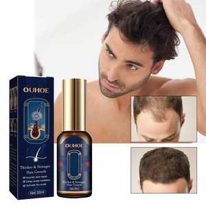 Suero Capilar OUHOE OEM de Marca Privada con Extracto de Plantas, Anti-Puntas Abiertas, Suavizante, Engrosador y Fortalecedor del Cabello, Estimulante del Crecimiento y Anticaída - Product Image 3