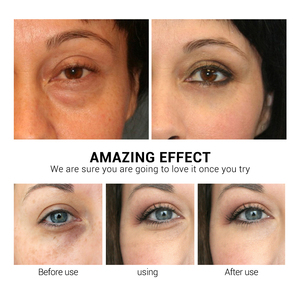 Patchs Masques Hydratants pour les Yeux à l'Acide Hyaluronique, Vitamine C et Rétinol – Répare les Rides, Réduit les Cernes et les Poches, Nourrit et Soin des Yeux - Product Image 4