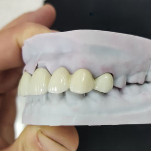 <span class=keywords><strong>Dents</strong></span> en zircone personnalisées de laboratoire dentaire numérique en Chine couronne et ponts en zircone solide - Product Image 2