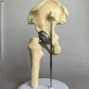 แบบจำลองข้อสะโพกเทียมรุ่นใหม่ปี 2025 คุณภาพสูงสำหรับการเรียนการสอนทางการแพทย์ - Product Image 2