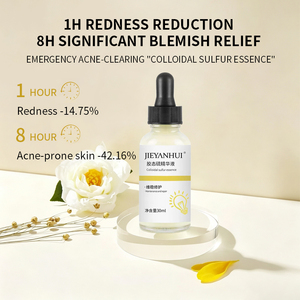 Suero de <span class=keywords><strong>Azufre</strong></span> Coloidal de Marca Privada para <span class=keywords><strong>el</strong></span> Acné, Corrector de Manchas Oscuras, Minimizador de Poros, Control de Grasa, Suero Facial Iluminador OEM - Product Image 4