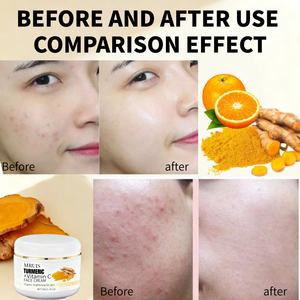 <span class=keywords><strong>Crema</strong></span> Facial Orgánica de Cúrcuma con Vitamina C, B5, <span class=keywords><strong>Aloe</strong></span> <span class=keywords><strong>Vera</strong></span>, Niacinamida y Vitamina E para Blanquear, Antiacné, Aclarar la Piel, Venta al por Mayor - Product Image 5