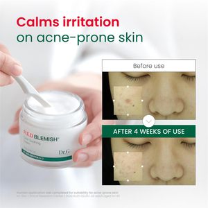 ครีมลดรอยแดง R.E.D Blemish Clear Soothing Cream 70 มล. มอยเจอร์ไรเซอร์เกาหลีสูตรปลอบประโลมผิว ด้วยสารสกัดจากใบบัวบก สำหรับผิวแดงและผิวแพ้ง่าย - Product Image 3