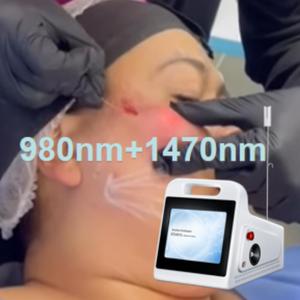Láser de lipólisis Endoliftin de 1470nm para relleno de glúteos BBL, inyecciones de lipólisis de grasa de 980nm, lifting facial, lipólisis, liposucción - Product Image 1