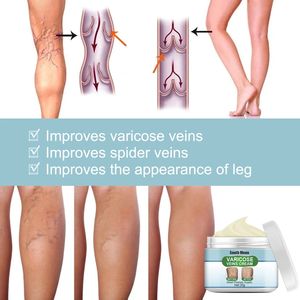 Crème pour les varices South Moon, phlébite, varices, inflammation des veines, crème pour les jambes - Product Image 4