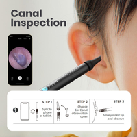 Kit de contrôle visuel intelligent pour la santé des oreilles, de la bouche et du nez, accessoire ORL, caméra pour le nettoyage des cérumen, appareil portable pour usage domestique, fournitures de nettoyage