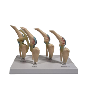 Modelo Comparativo de Articulación de <span class=keywords><strong>Rodilla</strong></span> Canina de Cuatro Etapas, Modelo de Demostración de Lesiones Articulares Normales, Tempranas, Moderadas y Avanzadas - Product Image 5