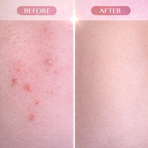 Suero para <span class=keywords><strong>la</strong></span> <span class=keywords><strong>Piel</strong></span> <span class=keywords><strong>de</strong></span> Cyperus Rotundus <span class=keywords><strong>de</strong></span> 60 ml, Depilación, Reparación, Nutrición <span class=keywords><strong>de</strong></span> <span class=keywords><strong>la</strong></span> <span class=keywords><strong>Piel</strong></span>, Reducción <span class=keywords><strong>de</strong></span> <span class=keywords><strong>la</strong></span> Irritación, Cuidado Posterior a <span class=keywords><strong>la</strong></span> Depilación - Product Image 5