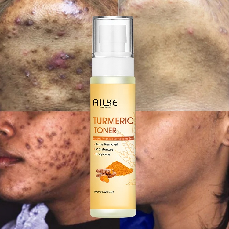 Wholesale Tumeric Toner Dark Spot Brightening Fades Blemishes Witch Hazel Black Skin Care Face Vitamin C Skin Toner