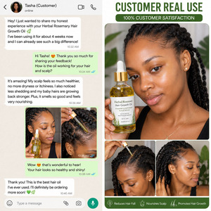 Huile de croissance capillaire à la menthe poivrée, biotine et huile de ricin, marque privée, pour la repousse des cheveux - Product Image 3