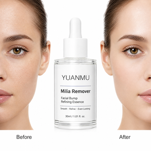 Suero para Eliminar Acné y Milias, Tratamiento Localizado para la Piel, Reparación Facial, Esencia Refinadora - Product Image 1