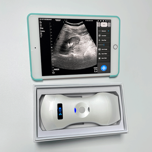 192 Element Phased Array cardiaco, lineare e convesso 3 in 1 Scanner ad ultrasuoni Color Doppler portatile - Product Image 2
