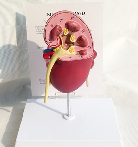نماذج أبحاث التشريح الطبي ، عالية الجودة, نماذج أمراض الكلى ونماذج الكلى الصحية - Product Image 3