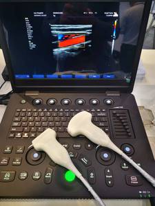SYA-SN40C 휴대용 15.6inc 컬러 도플러 초음파 기계 비뇨기과에 사용