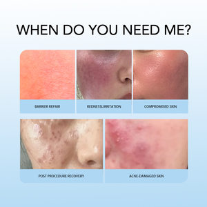 Spray Facial de Colágeno Recombinante de Marca Privada para Recuperación Post-Procedimiento, <span class=keywords><strong>Bruma</strong></span> Reparadora Estéril para Centros de Estética, Distribuidores - Product Image 4