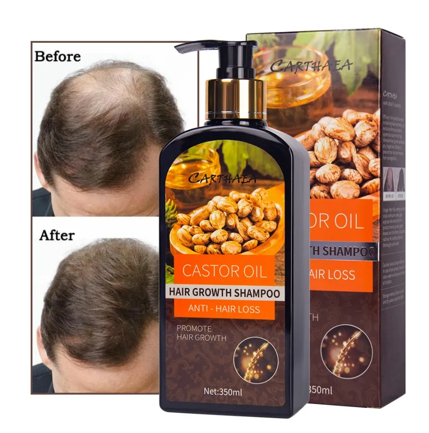 OEM private label wholesale 350ml castor oil shampoo for hair loss