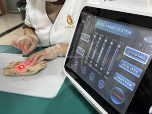 <span class=keywords><strong>Lipo</strong></span> Papada kalça kaldırma Liposuction 1470nm Liposuction diyot 980nm yağ tıbbi cerrahi Fiber optik yüz Y vücut Sculptra - Product Image 6