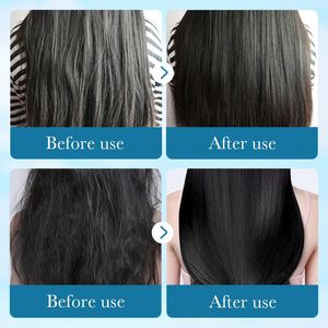 El Mejor Champú y Acondicionador para el Cuidado del Cabello <span class=keywords><strong>de</strong></span> Marca Privada, Anticaspa, Alivia la Picazón, con Aloe Vera - Product Image 6