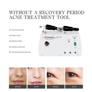 Dispositivo de Beleza Facial de Bio-microcorrente para Lifting, Antienvelhecimento, Firmador e Redutor de Rugas, Plugue dos EUA para Salão e Spa - Product Image 3