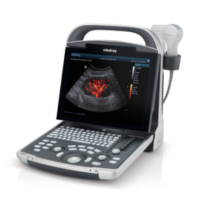 Appareil d'échographie numérique Mindray DP-30, portable, noir et blanc, pour vétérinaires, scanner de diagnostic par ultrasons, PW Power Doppler - Product Image 5