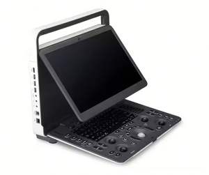 Ecocardiógrafo Sonoscape 15,6 pulgadas Sonoscape E1 E2 E2v Máquina de ultrasonido Doppler a color de alta resolución - Product Image 5