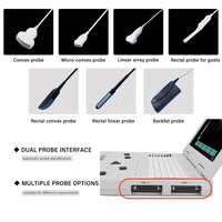 Échographe portable numérique noir et blanc pour diagnostic clinique obstétrical, gynécologique et abdominal humain
