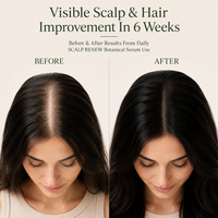 Serum Perawatan Kulit Kepala dan Folikel Rambut dengan Ekstrak Tumbuhan Redensyl Procapil, Capixyl, dan AnaGain, Private Label 4 Core Actives