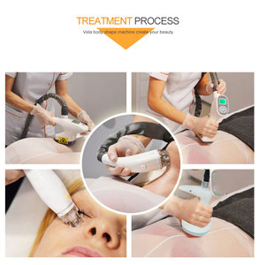 Máquina de Masaje Portátil con Rodillos de Vacío, Reafirma la Piel, Adelgaza Piernas y Brazos, Reduce la Celulitis, Relajación Corporal - Product Image 6