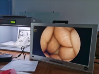 Système d'endoscopie vétérinaire portable OEM avec moniteur intégré pour utilisation avec une sonde rigide, endoscope vétérinaire 1080P