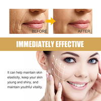 Masque Gel Hydratant Raffermissant Anti-rides pour le Visage, Atténue les Rides du Contour de la Bouche, Patch Anti-rides Nasogéniennes à l'Or 24K pour Peaux Mixtes Sèches