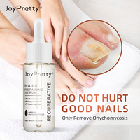 Sérum de traitement des ongles fongiques, soin liquide réparateur des pieds, blanchiment des ongles des pieds, gel anti-infection pour éliminer les champignons des ongles