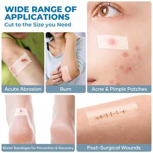 Rollo de hidrocoloide cortado a medida Vendajes para el cuidado de heridas Acné Espinilla - Product Image 3