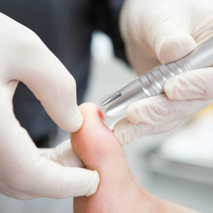 Máquina <span class=keywords><strong>láser</strong></span> de <span class=keywords><strong>hongos</strong></span> en las <span class=keywords><strong>uñas</strong></span> de alta potencia a <span class=keywords><strong>precio</strong></span> de fábrica, <span class=keywords><strong>Láser</strong></span> de <span class=keywords><strong>hongos</strong></span> en las <span class=keywords><strong>uñas</strong></span> utilizado para <span class=keywords><strong>hongos</strong></span> en las <span class=keywords><strong>uñas</strong></span> de los pies - Product Image 4