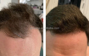 เซรั่มบำรุงเ<span class=keywords><strong>ส</strong></span>้น<span class=keywords><strong>ผม</strong></span><span class=keywords><strong>ส</strong></span>ูตรธรรมชาติ OEM ODM <span class=keywords><strong>ส</strong></span>ำหรับผู้ชา<span class=keywords><strong>ย</strong></span>และผู้หญิง เพื่อผมแข็งแรงขึ้น หนาขึ้น และยาวขึ้นอย่างเป็นธรรมชาติ แบบส<span class=keywords><strong>เป</strong></span>รย์ - Product Image 4