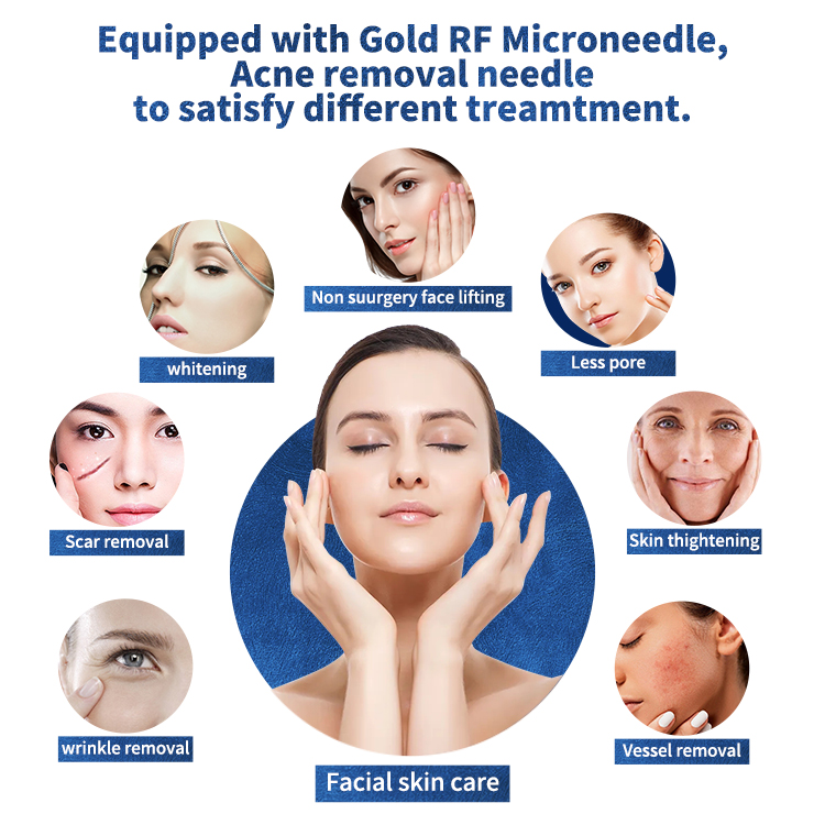Fractional Microneedling RF Radio Frequency Microneedling Microneedle Radiofrequency Micro Needle Fractional Rf