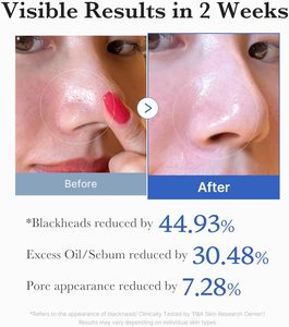 Medicube Hydrocolloid Acne <span class=keywords><strong>Patch</strong></span> & Pimple <span class=keywords><strong>Patch</strong></span>-Absorbente de pus, invisible, transpirable para todo tipo de piel - Product Image 4