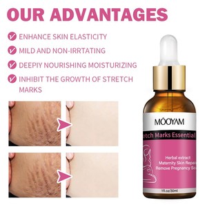 Best-seller MOOYAM, crème réparatrice pour les vergetures de grossesse, resserrement de la peau, éliminateur de vergetures - Product Image 3