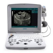 Edan DUS 60 VET Animal Ultrasound Equipment Multi-function PW Doppler Portable Veterinary Ultrasound Machine - Product Image 3