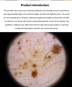 Portable Dermatoscope 10x Magnification Skin Scope with Multi-Light Modes for Dermatologists & Home Skin Monitoring - Product Image 3