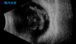 Escáner Oftálmico SK-3000A, Equipo de Oftalmología con Escaneo AB, Instrumento de Ultrasonido <span class=keywords><strong>Ocular</strong></span> - Product Image 3