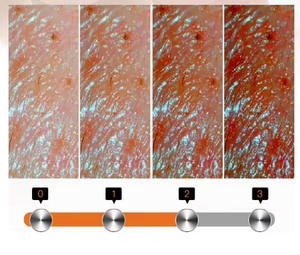 New 3D Intelligent Skin Analyzer Desktop Skin Analyzer Facial Skin Diagnostic Device AI Skin Analysis System - Product Image 6