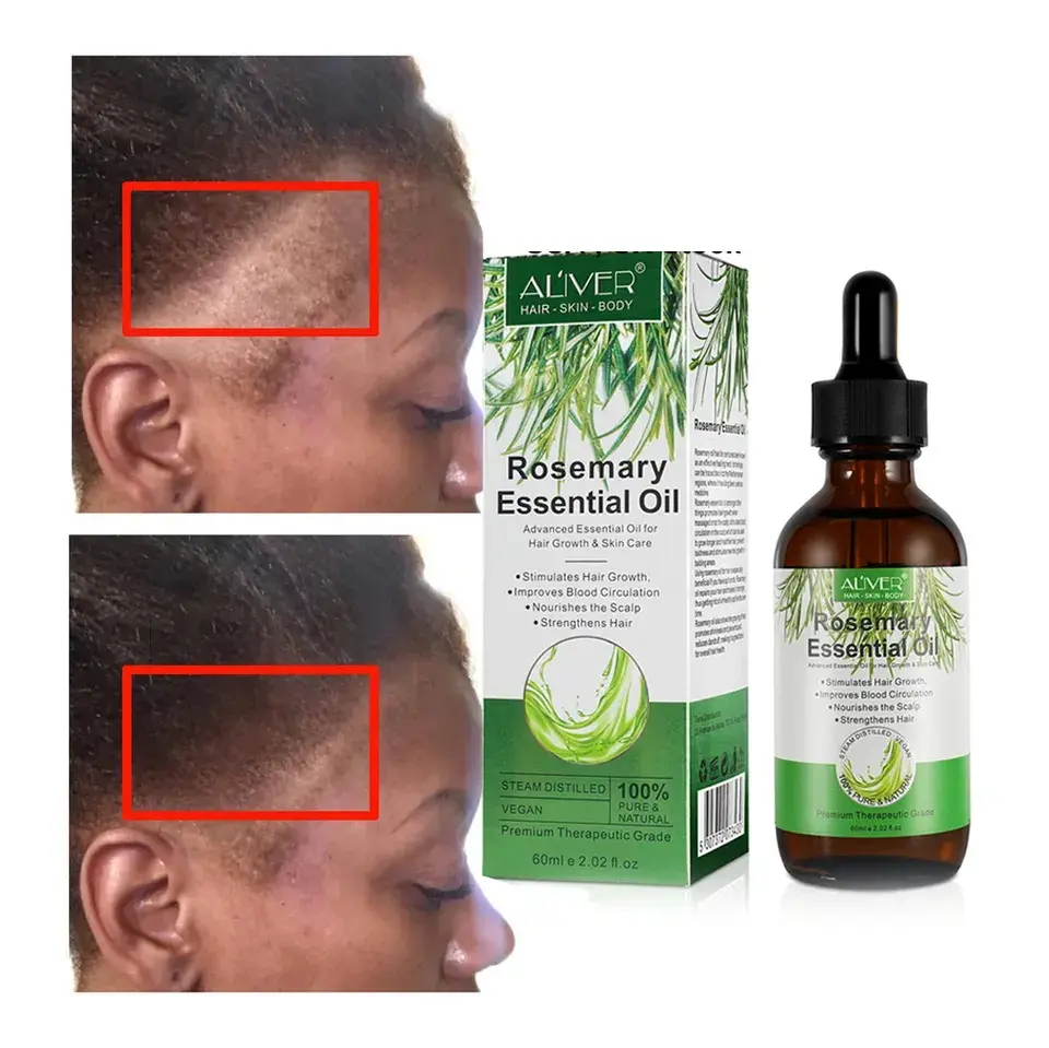 USA UK In Stock Private Label Hair Care Products Essential Oil Bulk Natural Pure Rosemary Oil Hair Growth