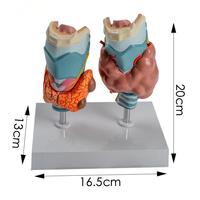 Modèle d'anatomie pathologique thyroïdienne médicale pour l'enseignement et la démonstration
